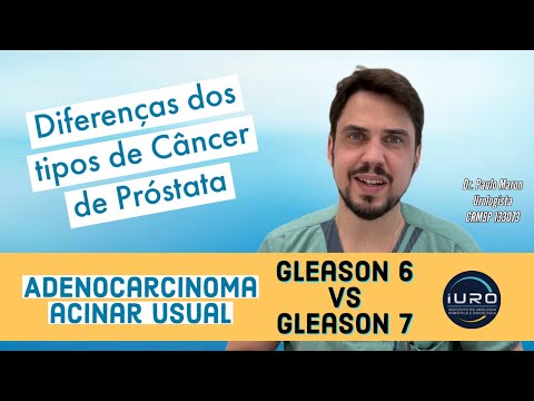 Principais diferenças entre