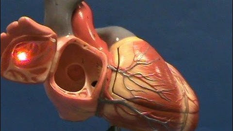 Heart Model II - Right Atrium