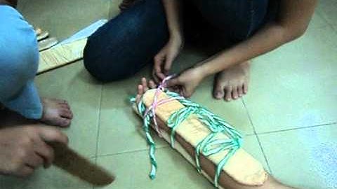 Sơ Cấp Cứu Ban Đầu - Gãy Xương Cẳng Tay