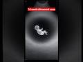 10-Weeks Ultrasound Scan | Realistic Fetus Visual at Sonogram
