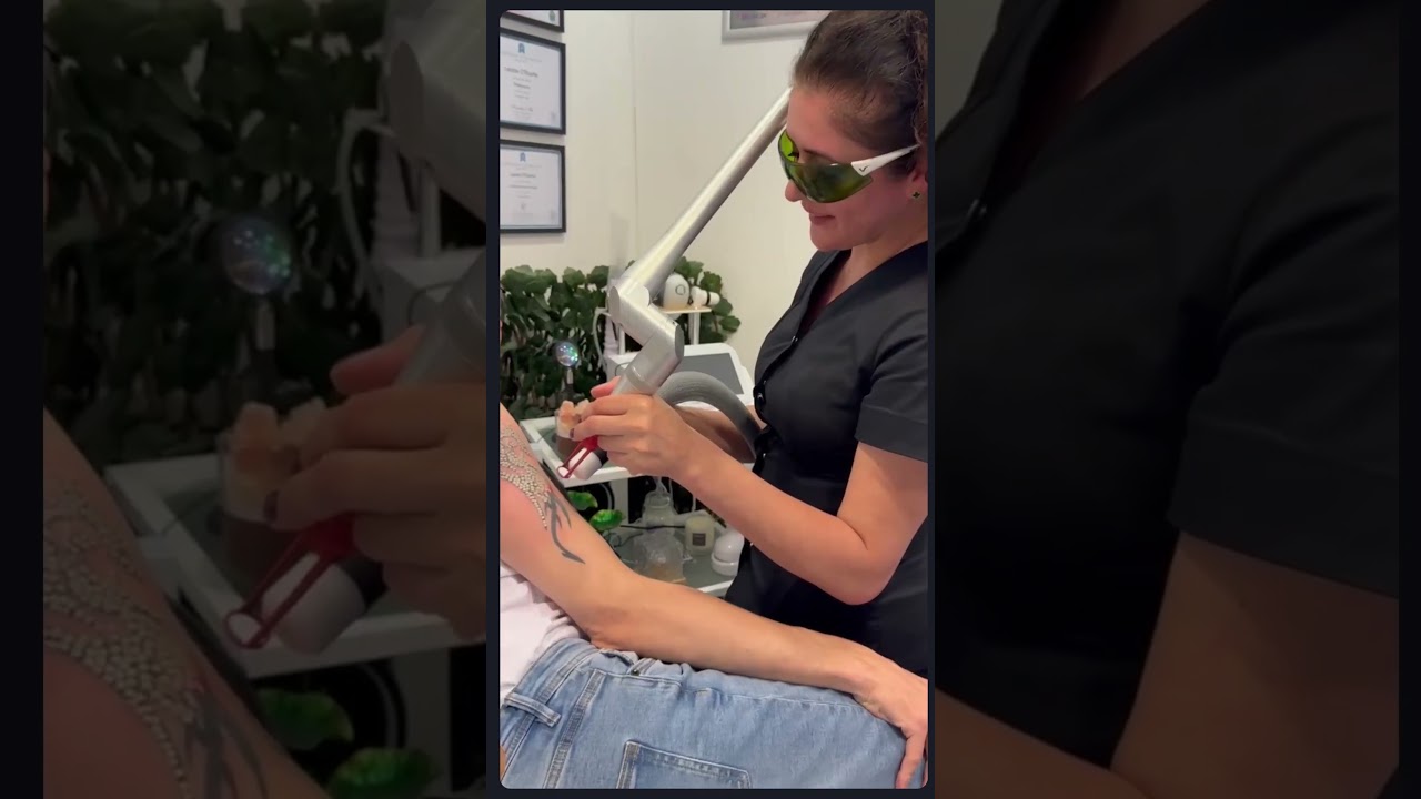 ✨ Clear Your Skin with Laser Tattoo Removal! ✨