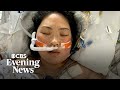 Woman receives heart transplant after suffering rare condition post-childbirth