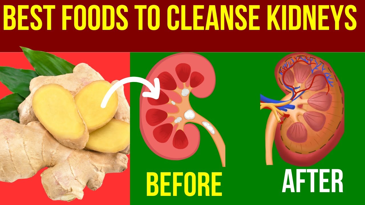 10 Foods That Will CLEANSE Your Kidneys FAST - YouTube
