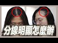 åˆ†ç·šæ˜Žé¡¯è©²æ€Žéº¼è¾¦?é˜¿å½¬çš„5ç¨®è§£æ±ºæ–¹æ³•ï½œæšæ£„ï½œç²˜é˜¿å½¬