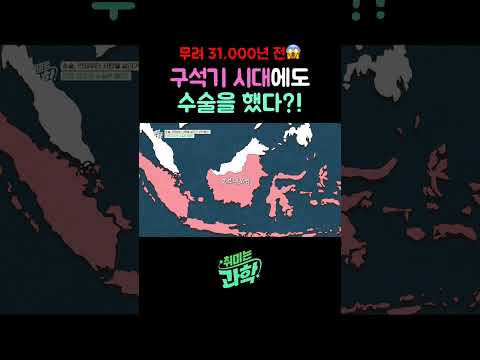 무려 31,000년 전😱 구석기 <strong>시대에도</strong> 수술을 했다?! #취미는과학 #수술 #인류최초수술 #최초