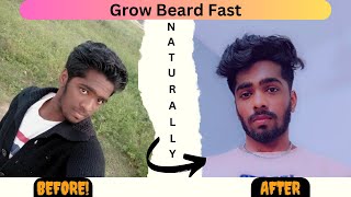 How To Grow Beard Faster And Naturally