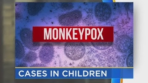 CDC Confirms First 2 Monkeypox Cases In Children In United States