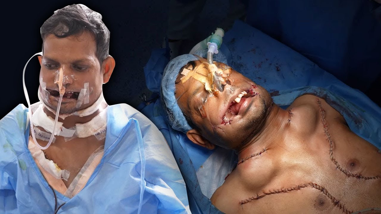 Devastating Impact of Smoking and Chewing Tobacco