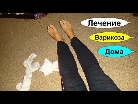 Вены на ногах. Лечение варикоза. Закупорка сосудов. Тромбы. Целебный сбор растений