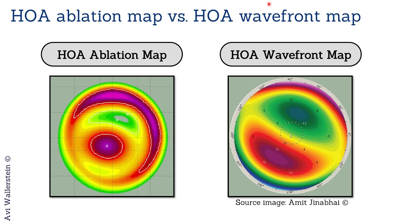 Keratoconus Diagnosis: Novel Insights from Corneal HOA Maps