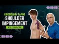 Kinesiology Taping for Shoulder Impingement With Explanation on Technique