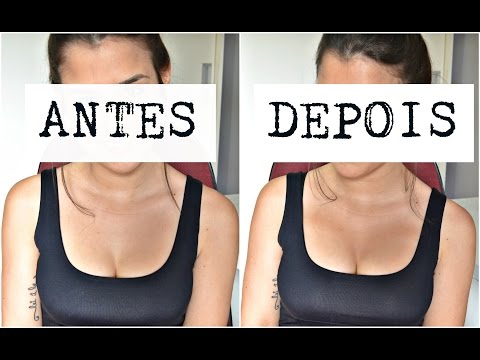 Vídeo: Como Aumentar Os Seios Com Nutrição