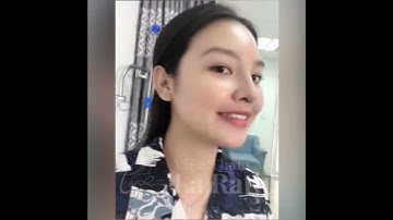 Dáng mũi đẹp mọi góc nhìn của chị Kim Xuyên sau nâng mũi Mega S+