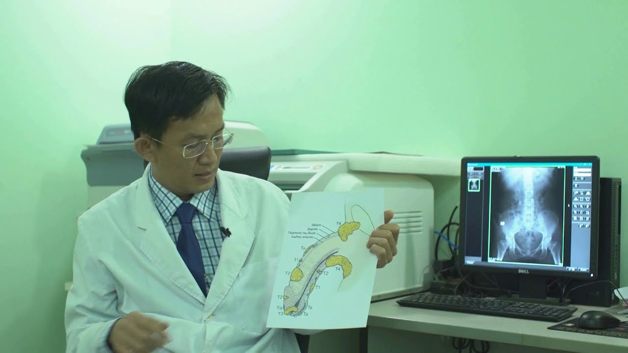 ជំងឺមហារីក លិង្គ Penis Cancer