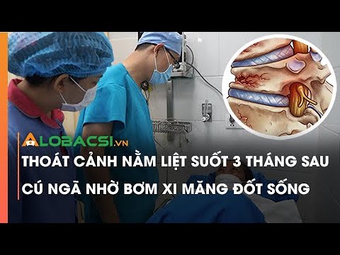 Video Thoát cảnh nằm liệt suốt 3 tháng sau cú ngã nhờ bơm xi... - YouTube