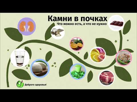 Камни в почках. Что есть можно, а что не нужно