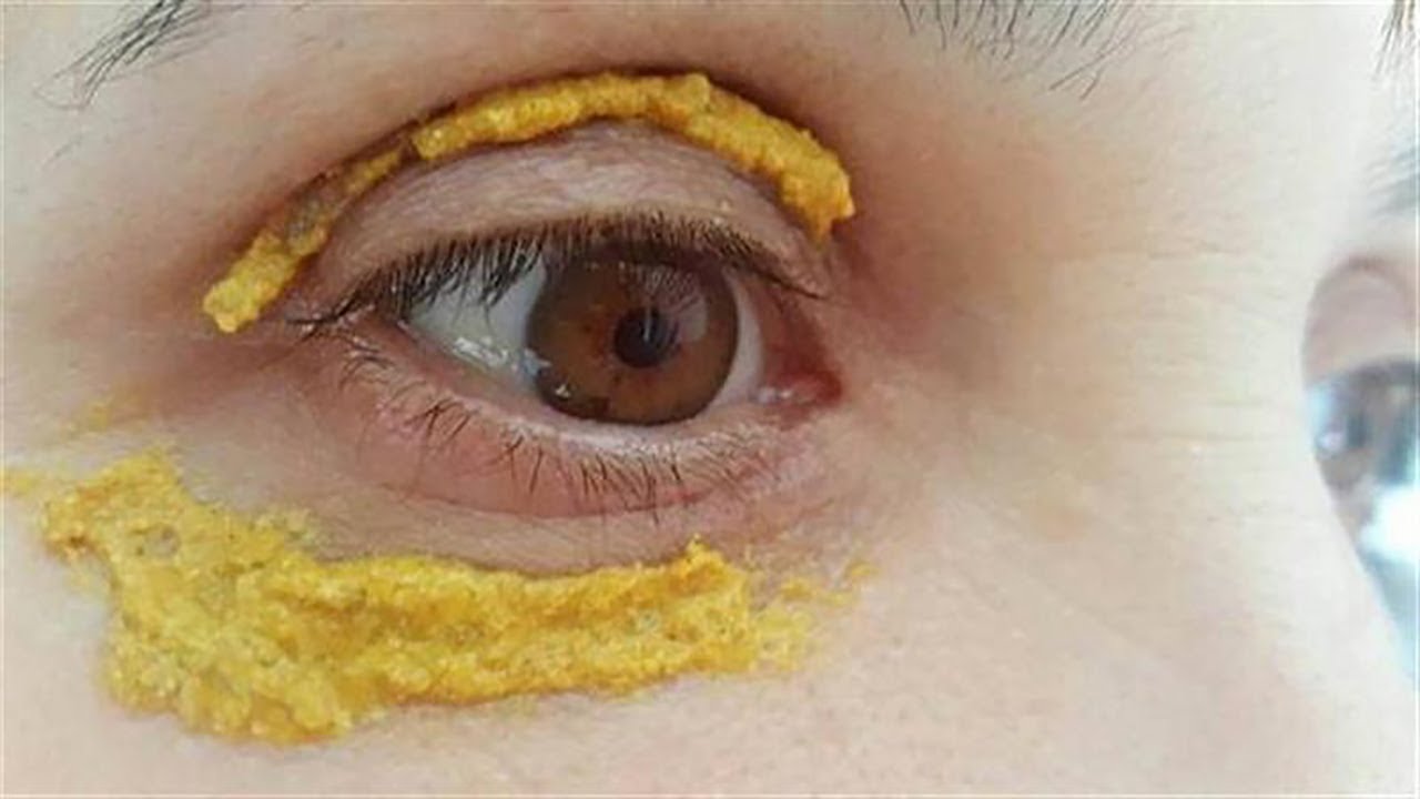 She Put Turmeric Around The Eyes, 5 Days Later, Something Incredible