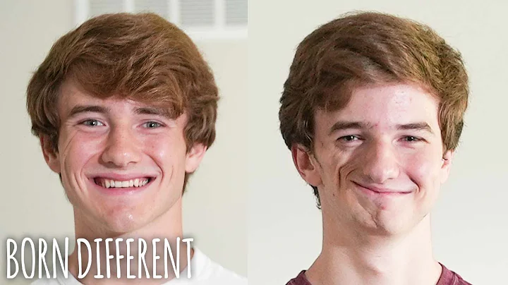 We're Identical Twins - But Only On One Side | BOR...