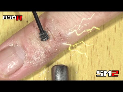 【眠くなるアトピー性皮膚炎ASMR】超痒い指のあかぎれを黒三連円盤耳かきで掻く音/癒し/リラックス効果/睡眠導入/マッサージ