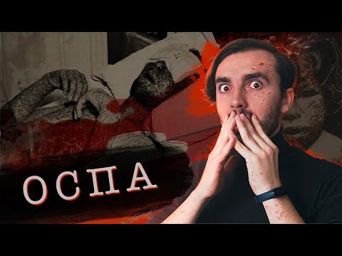 Чёрная Оспа - [История Медицины]