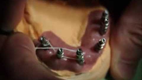 How to Make an Implant Verification Jig