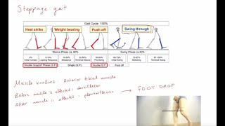 Abnormal Gaits I Amena Ali I Anatomy Made Easy