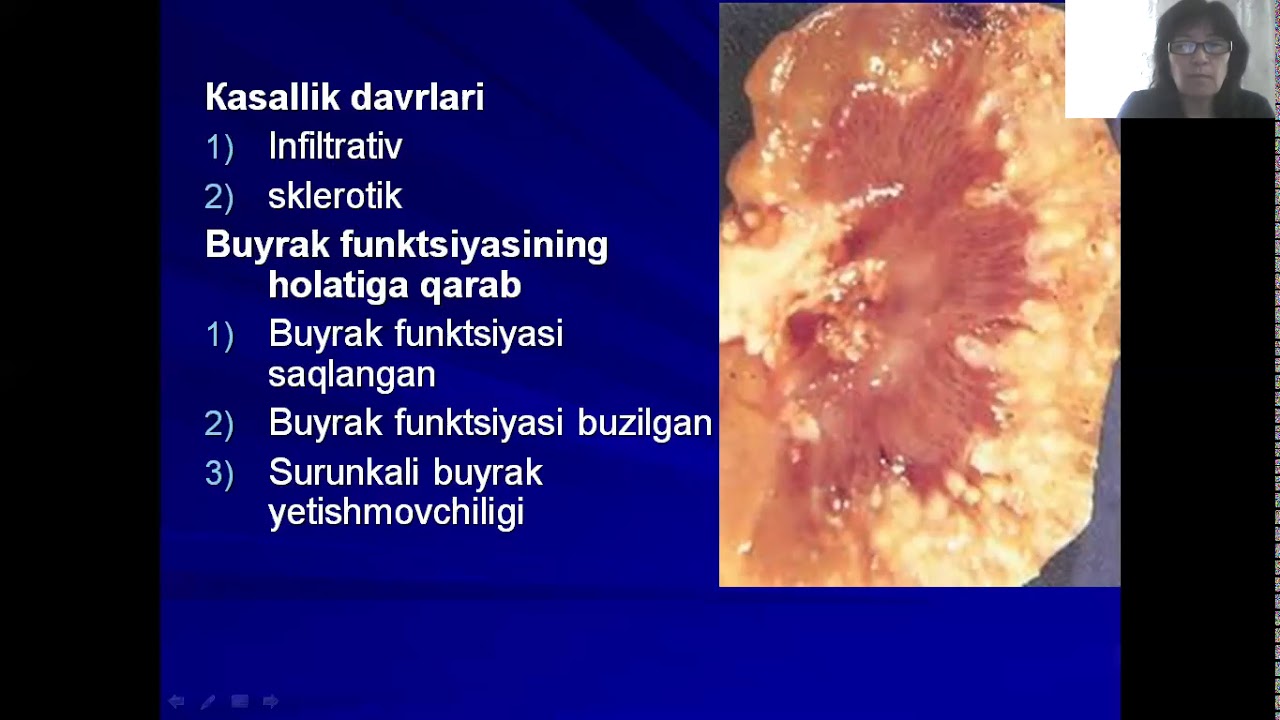 Калина при пиелонефрите