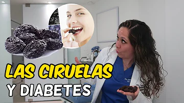 ¿Está bien comer 5 ciruelas pasas al día?