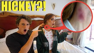 HICKEY PRANK on STROMEDY!! (he FREAKED out)