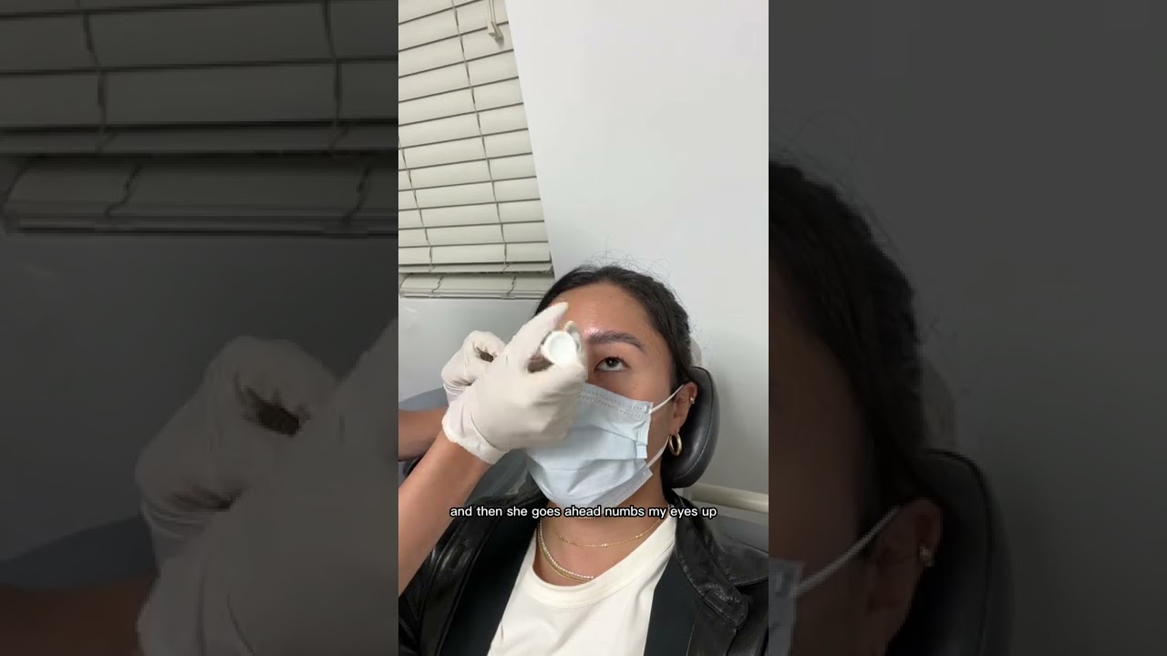 SQUEEZING MY EYELID PIMPLES (ilux treatment for dry eyes)