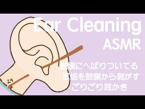 【ASMR】鼓膜にはりついている耳垢を鼓膜から剥がすごりごり耳かき Ear Cleaning 【No Talking】