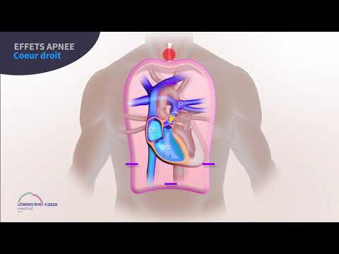 Interaction Cœur-Poumons dans le traitement des apnées du sommeil