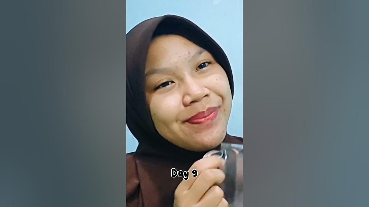 REVIEW JUJUR NEWLAB COLLAGEN DALAM 15 HARI MEMUDARKAN BEKAS JERAWAT #beaudelab #collagen #newlab REVIEW JUJUR NEWLAB COLLAGEN DALAM 15 HARI MEMUDARKAN BEKAS JERAWAT #beaudelab #collagen #newlab