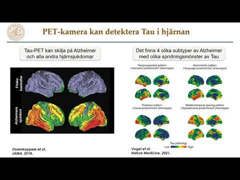 Video: Hur diagnostiseras Candidemi?