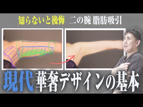 知っていれば失敗しない 【現代脂肪吸引】二の腕 華奢デザインのポイントを専門のDrが解説｜vol.659【ボディデザインTV】