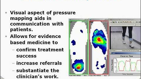 "Pressure Mapping in My Practice" -   a DPM