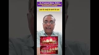ENT problems affecting oral health #trendingshorts #mouthbreathing #sinusitis #doctor #drpnaharudr