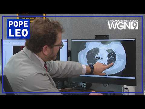 Pope Leo has lung cancer. Local doctor explains diagnosis and next steps | Medical Watch