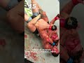 𝗣𝗙𝗟 𝗛𝗢𝗟𝗜𝗗𝗔𝗬 𝗛𝗜𝗧𝗦: 1️⃣5️⃣ A reminder to never let Antonio Carlos Jr. grab a hold of your neck 🐍😤
