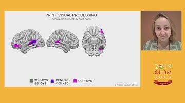 OHBM 2019 | Oral Sessions | Brain Circuit for Word Processing Differentiate Children with Dist…