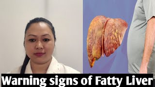 What are the common signs &symptoms of fatty liver??😨How to treat/what are the Preventive measures?
