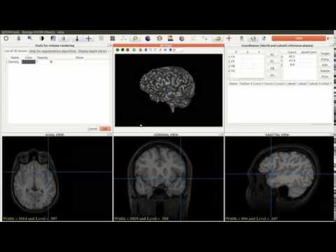 Brain extraction and mesh visualization in JimboDICOMViewer