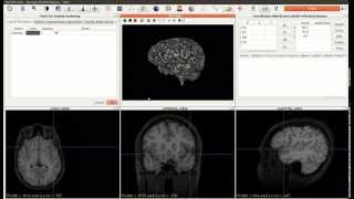 Brain extraction and mesh visualization in JimboDICOMViewer Profile