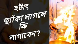 রান্না করার সময় হটাৎ ছ্যাঁকা লাগলে কি লাগাবেন | burn first aid tips | b2utips