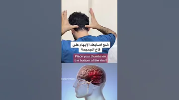 ياطبيب محتاج علاج للصداع 