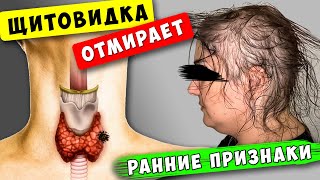 10 ранних Признаков, что ваша ЩИТОВИДКА ОТМИРАЕТ. 90% с проблемами щитовидки, даже НЕ знают об этом