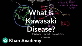 What is Kawasaki disease? | Circulatory System and Disease | NCLEX-RN | Khan Academy