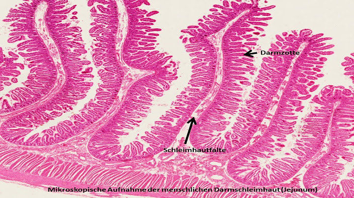 Was ist der unterschied zwischen globularia punctata und glomerata