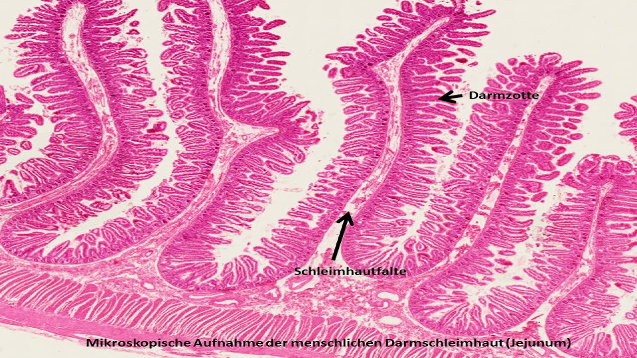 immunglobulin a kerek féreghez)