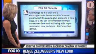 Renée Zellweger's New Look Examined by Plastic Surgeon Dr. Daniel I. Shapiro